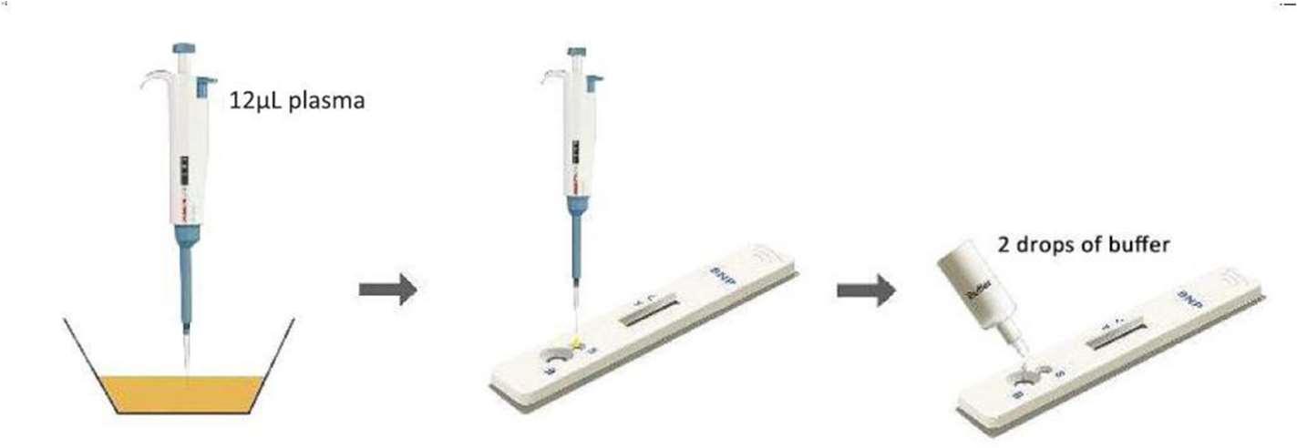 N-terminal pro-Brain Natriurtic Peptide Rapid Test Device1