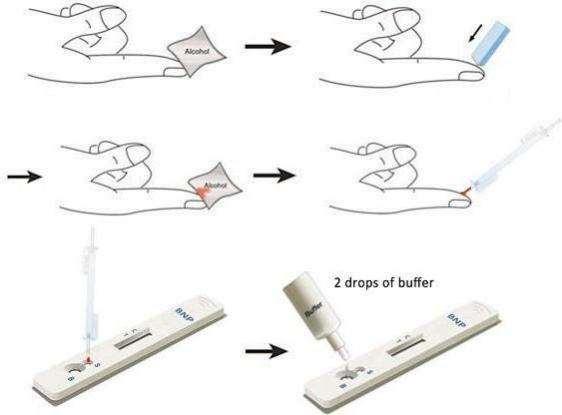 N-terminal pro-Brain Natriurtic Peptide Rapid Test Device2